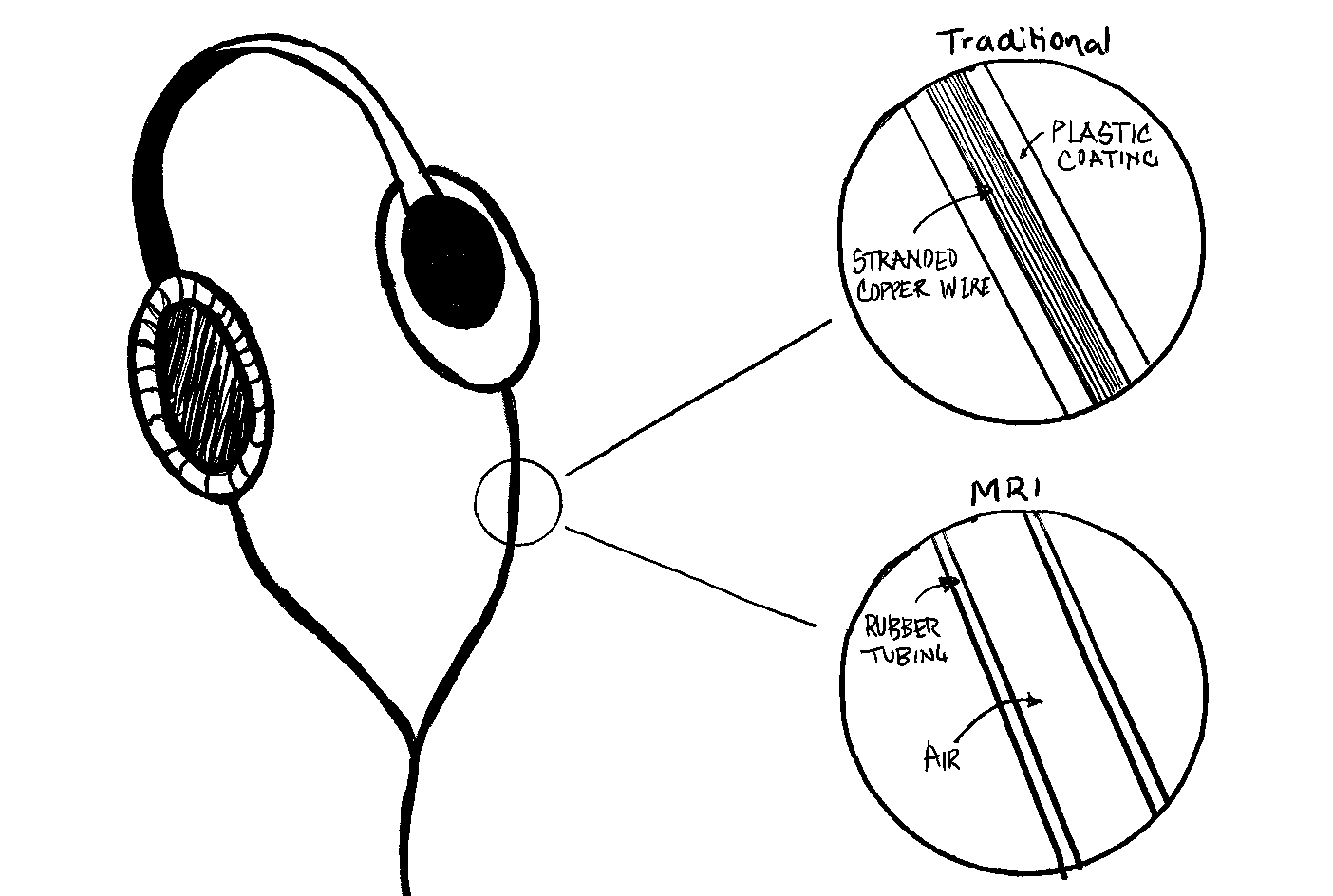MRI Headphones vs. Traditional